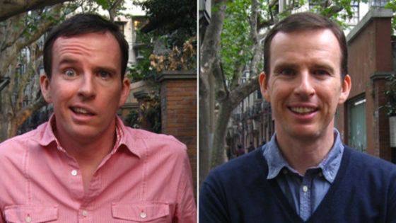 Famosos com paralisia facial John Sudworth - Reporter da BBC Antes e depois